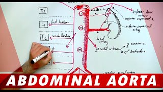 Abdominal Aortic Aneurysm AAA Ultrasound [upl. by Aldridge]