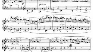 Beethoven Sonata quotPathetiquequot Op 13  III Rondo Allegro [upl. by Sauder]