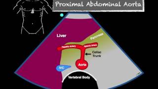 Anatomy  Abdominal Aorta Branches [upl. by Anilatac]