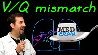 Ventilation Perfusion VQ Mismatch Explained Clearly [upl. by Atiugal]