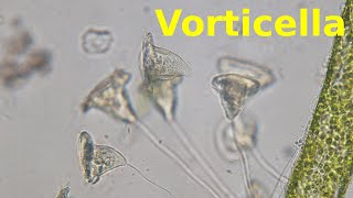 Vorticella  Under the Microscope [upl. by Jaymie]