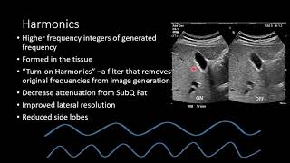 Ultrasound Physics  Image Generation [upl. by Ahsimot232]