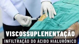 INFILTRAÇÃO NO JOELHO DO ÁCIDO HIALURÔNICO VISCOSSUPLEMENTAÇÃO parte 1 [upl. by Charlean]