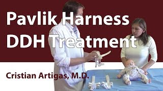 Pavlik Harness DDH Treatment [upl. by Ij263]