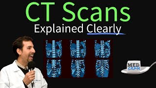 CT Scan of the Chest Explained Clearly  High Resolution CT Scan HRCT [upl. by Idou]