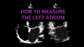 Measuring the LEFT ATRIUM VOLUME Echocardiography [upl. by Oneill126]